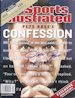 Pete Rose 75 702